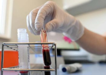 கொரோனாவிற்கு  பிளாஸ்மா சிகிச்சை முதல் நோயாளி குணமடைந்து டிஸ்சார்ஜ்!